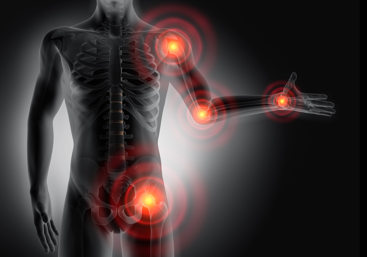 Causes of Joint Inflammation South Shore Orthopedics