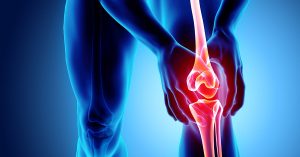 Knee painful - skeleton x-ray, 3D Illustration medical concept; blog: 4 Keys to Knee Replacement Recovery